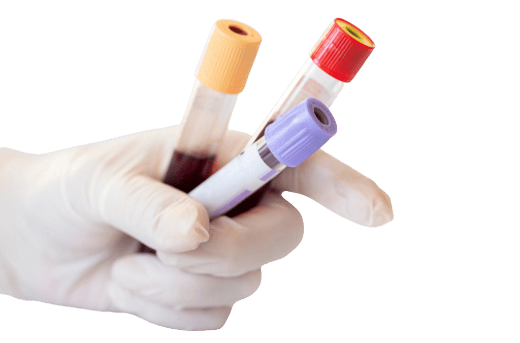 Blood Test Benefits and What They Can Tell You